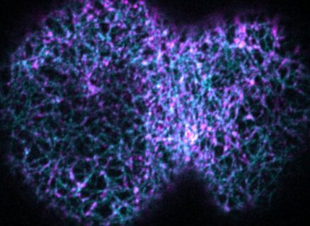 Towards entry "A novel type of contractile ring enables cell division"